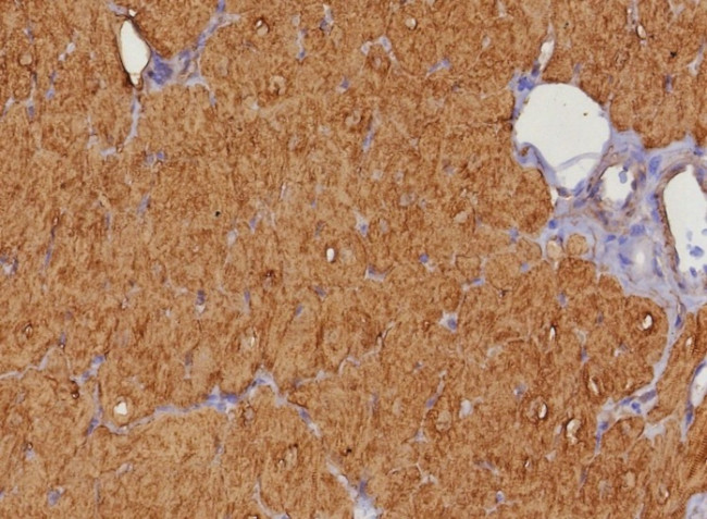 Heart Fatty Acid Binding Protein (H-FABP)/FABP3 Antibody in Immunohistochemistry (Paraffin) (IHC (P))