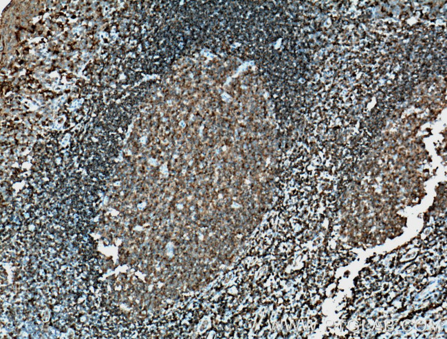 HLA-DMB Antibody in Immunohistochemistry (Paraffin) (IHC (P))