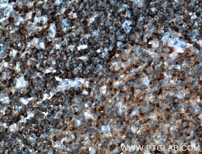 HLA-DMB Antibody in Immunohistochemistry (Paraffin) (IHC (P))