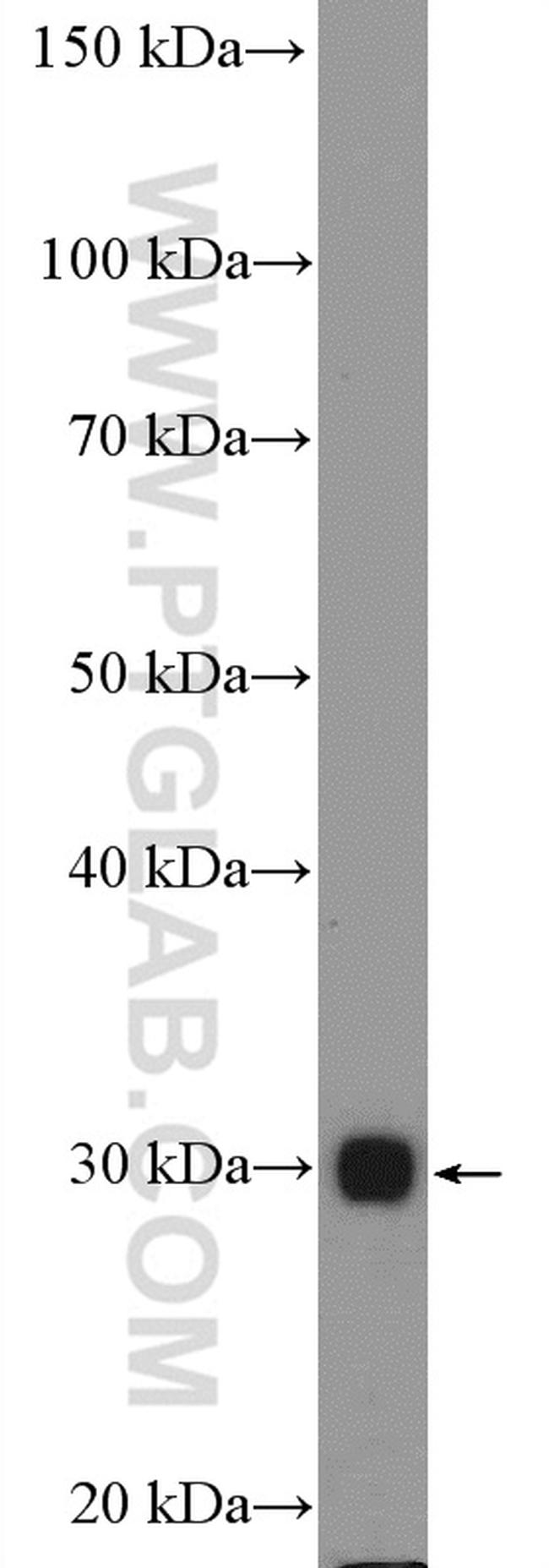 HLA-DMB Antibody in Western Blot (WB)