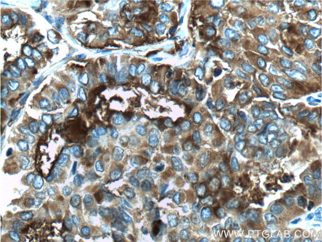 Thyroglobulin Antibody in Immunohistochemistry (Paraffin) (IHC (P))