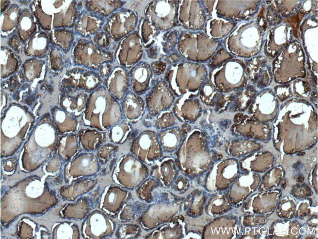 Thyroglobulin Antibody in Immunohistochemistry (Paraffin) (IHC (P))