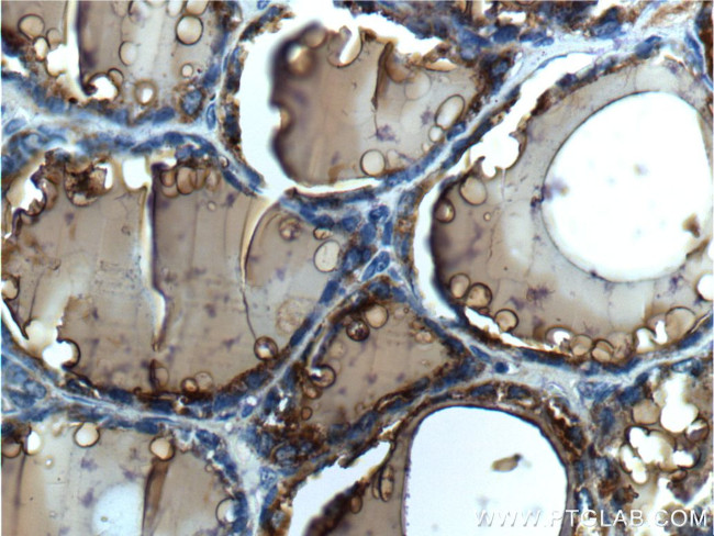 Thyroglobulin Antibody in Immunohistochemistry (Paraffin) (IHC (P))