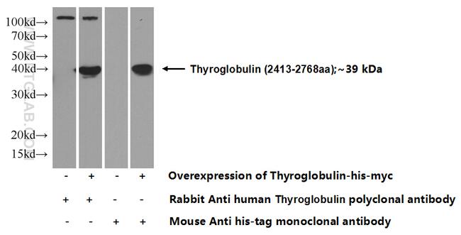 Thyroglobulin Antibody in Western Blot (WB)