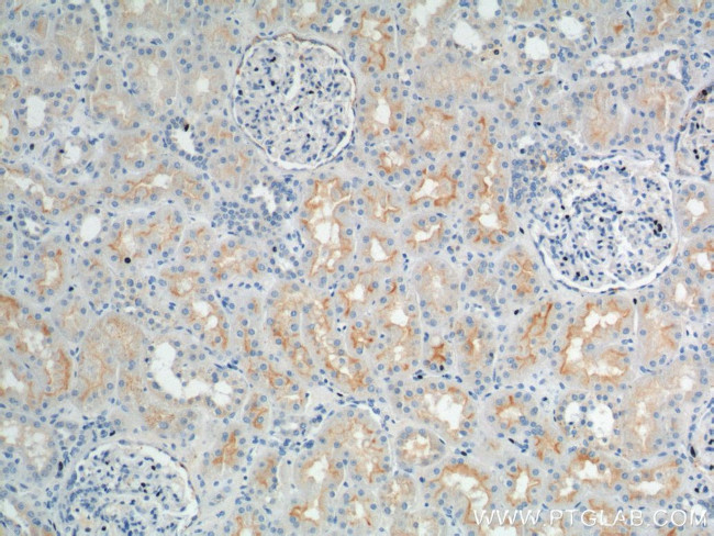 SLC13A2 Antibody in Immunohistochemistry (Paraffin) (IHC (P))