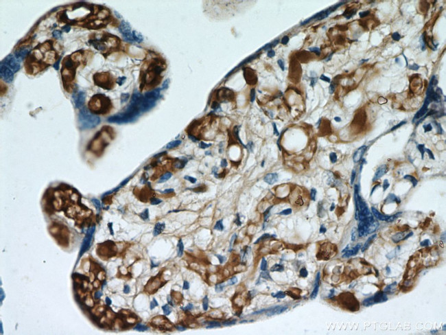 pregnancy zone protein Antibody in Immunohistochemistry (Paraffin) (IHC (P))