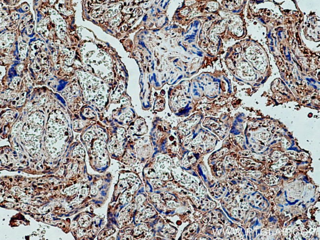 pregnancy zone protein Antibody in Immunohistochemistry (Paraffin) (IHC (P))