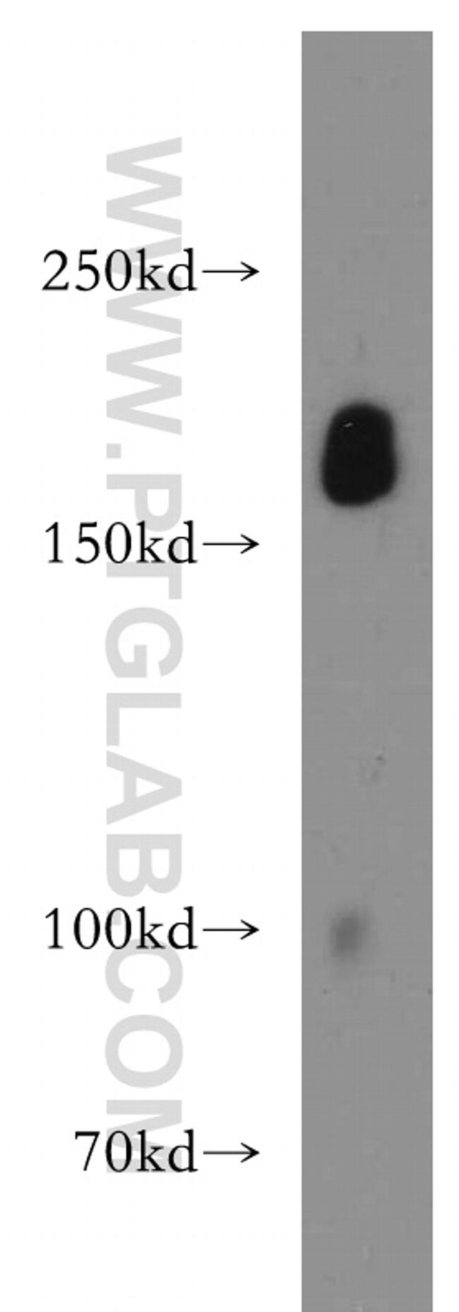 pregnancy zone protein Antibody in Western Blot (WB)