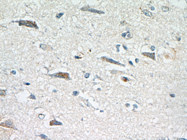 pregnancy zone protein Antibody in Immunohistochemistry (Paraffin) (IHC (P))