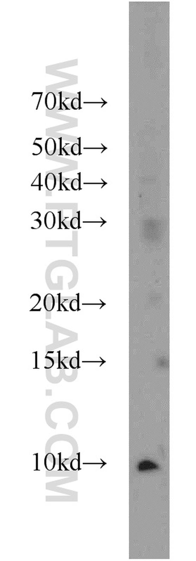 HIGD1A Antibody in Western Blot (WB)