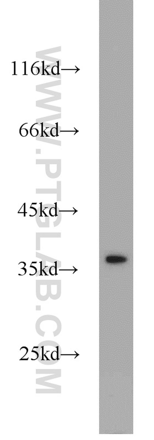 TTF1/NKX2-1 Antibody in Western Blot (WB)