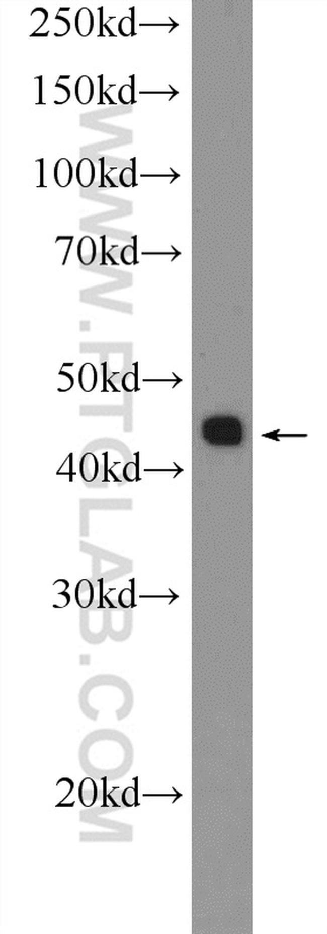 TTF1/NKX2-1 Antibody in Western Blot (WB)