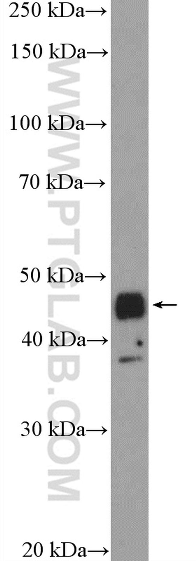 TTF1/NKX2-1 Antibody in Western Blot (WB)