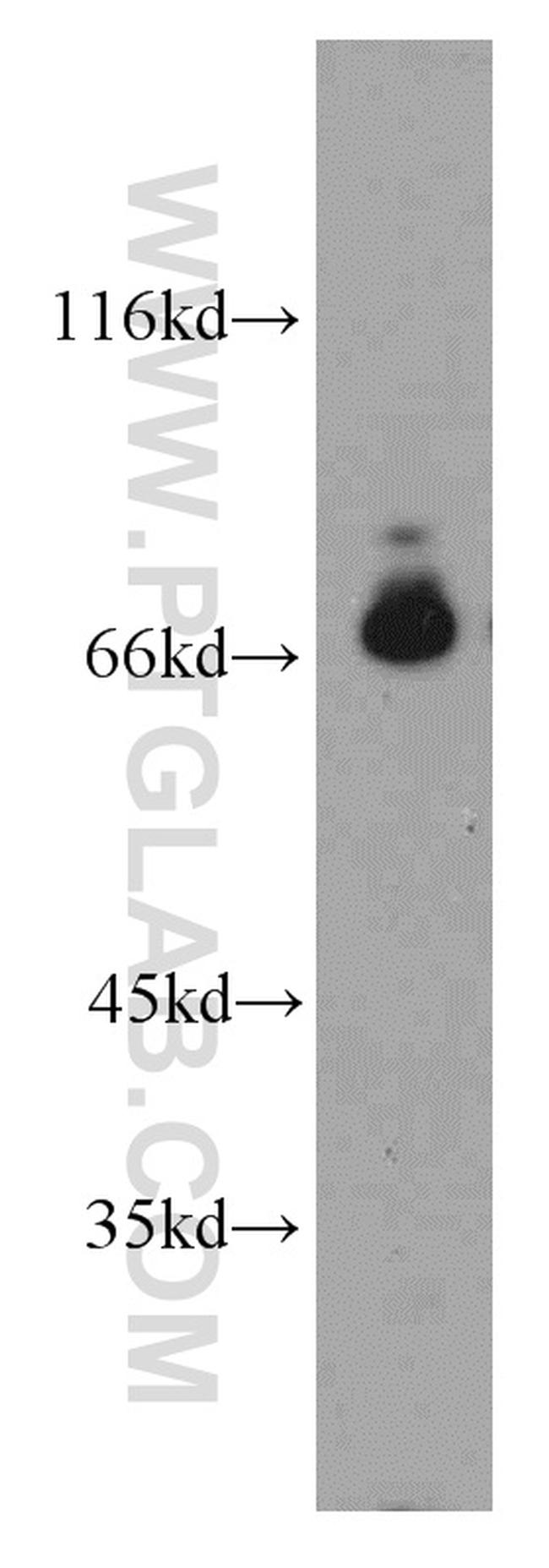 POLA2 Antibody in Western Blot (WB)