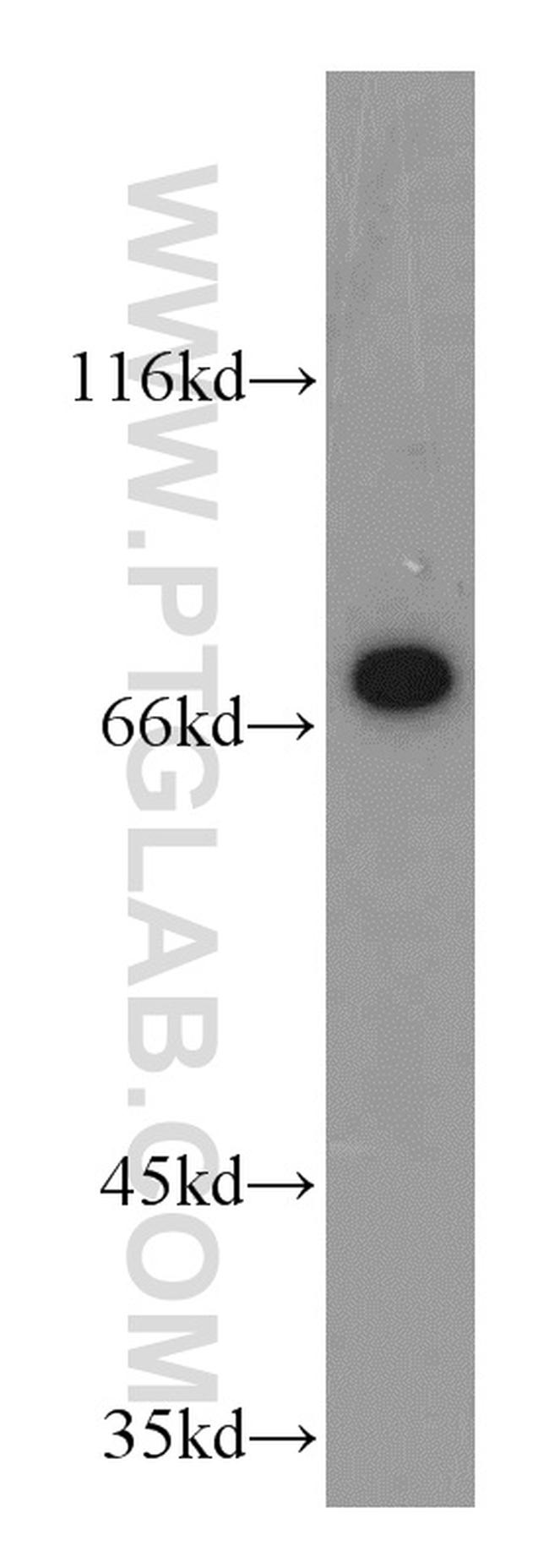 POLA2 Antibody in Western Blot (WB)