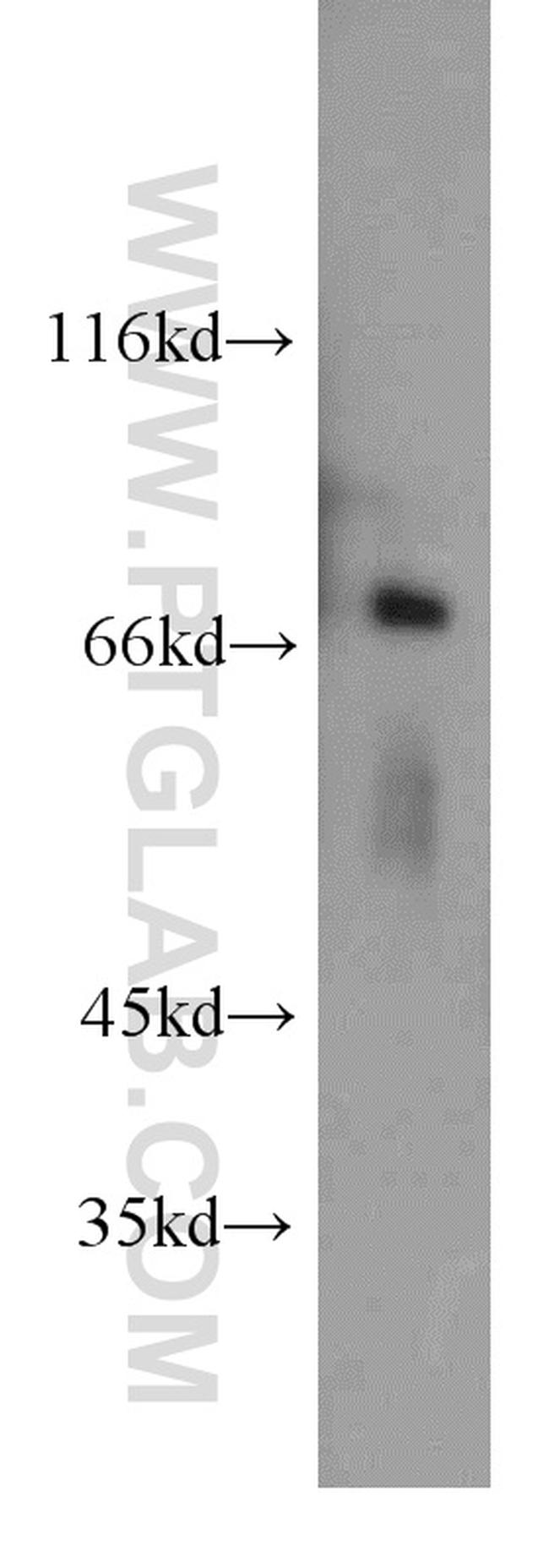 POLA2 Antibody in Western Blot (WB)