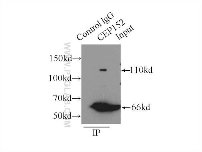 CEP152 Antibody in Immunoprecipitation (IP)