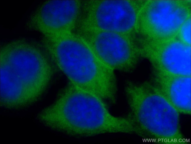 GLUT1 Antibody in Immunocytochemistry (ICC/IF)