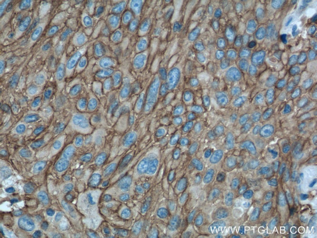 GLUT1 Antibody in Immunohistochemistry (Paraffin) (IHC (P))