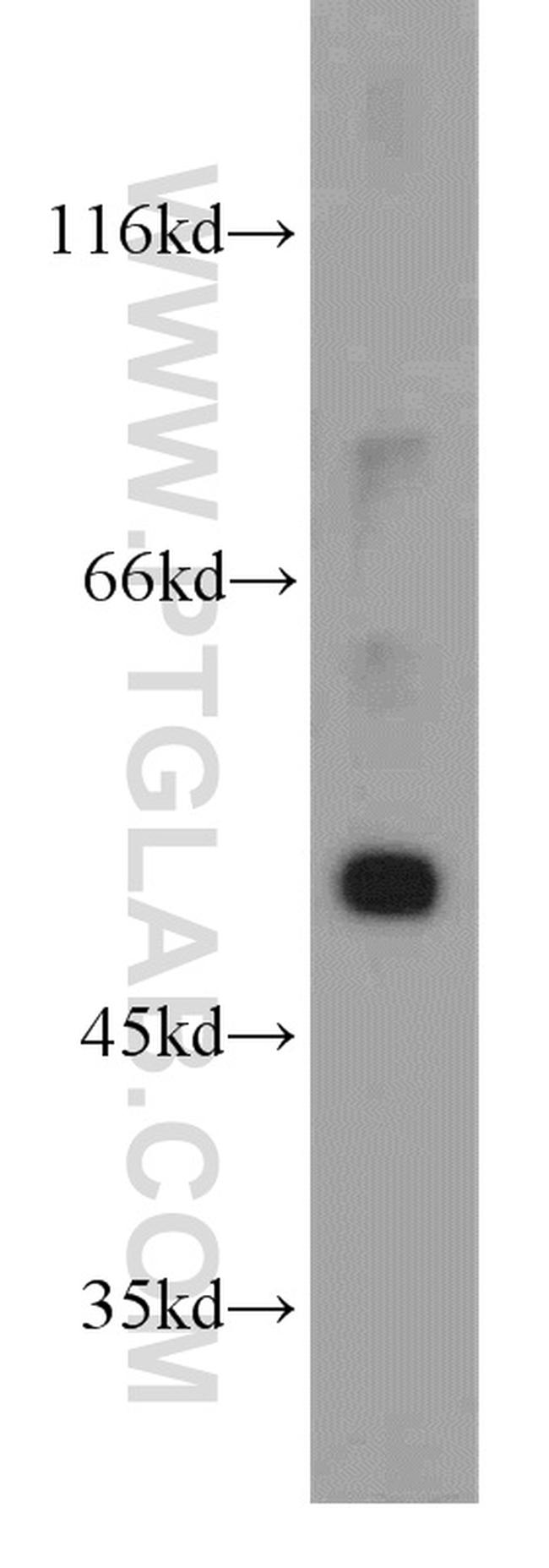 GLUT1 Antibody in Western Blot (WB)