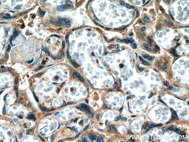 Collagen Type XI Antibody in Immunohistochemistry (Paraffin) (IHC (P))