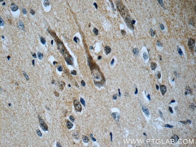 CHT1 Antibody in Immunohistochemistry (Paraffin) (IHC (P))