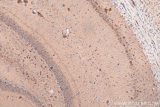 CHT1 Antibody in Immunohistochemistry (Paraffin) (IHC (P))