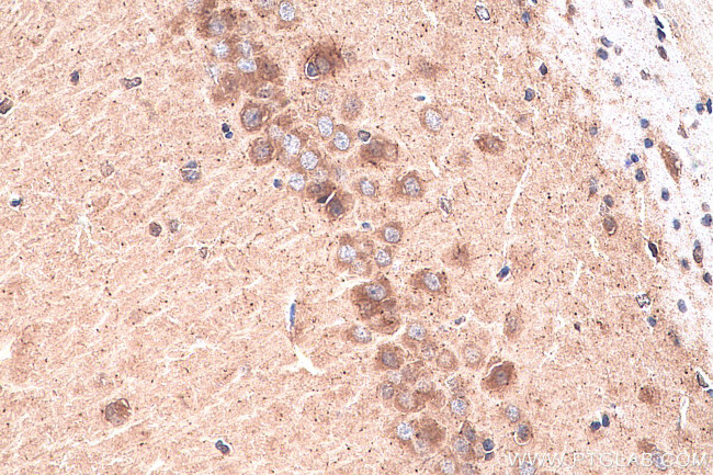 CHT1 Antibody in Immunohistochemistry (Paraffin) (IHC (P))