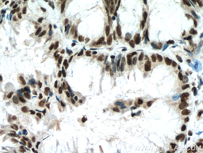 RBM7 Antibody in Immunohistochemistry (Paraffin) (IHC (P))