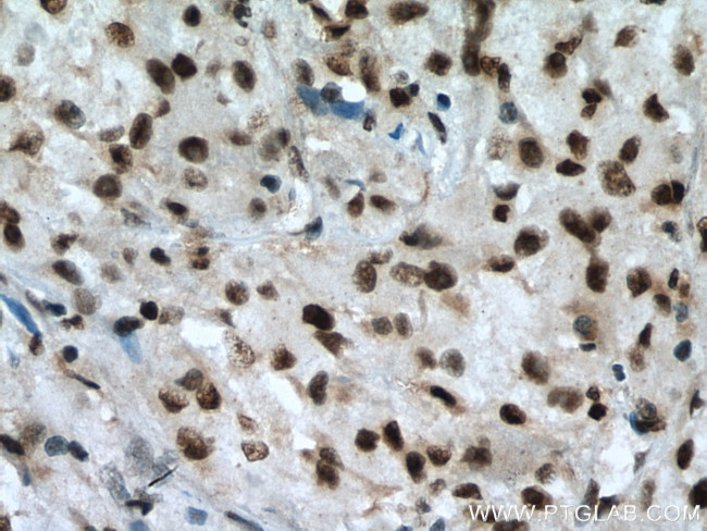 RBM7 Antibody in Immunohistochemistry (Paraffin) (IHC (P))