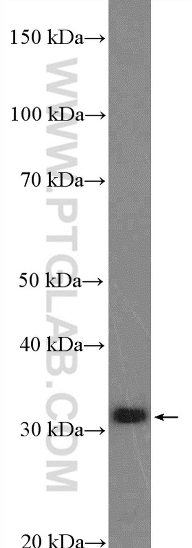 RBM7 Antibody in Western Blot (WB)