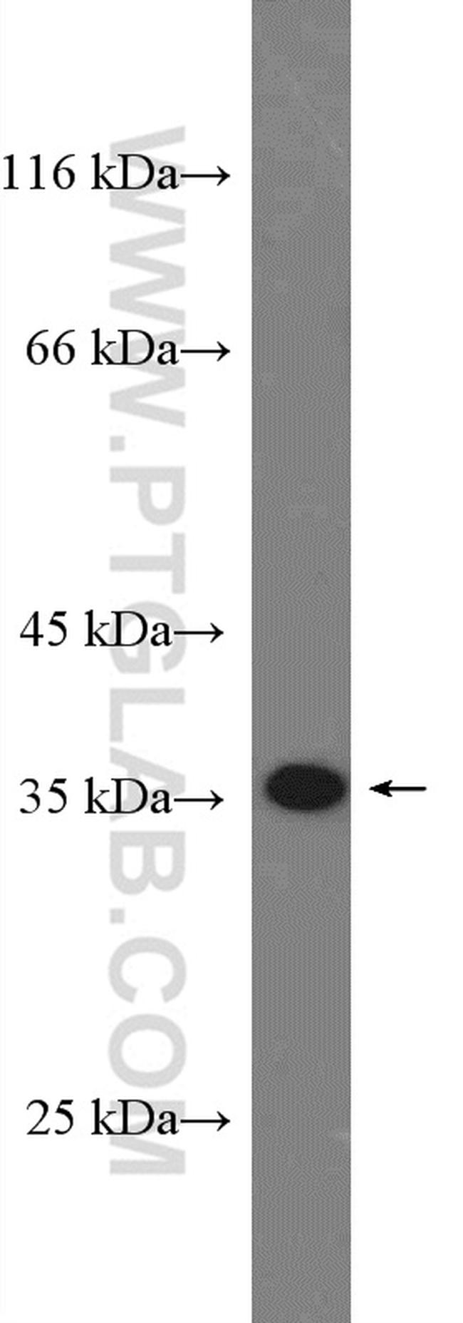 RBM7 Antibody in Western Blot (WB)