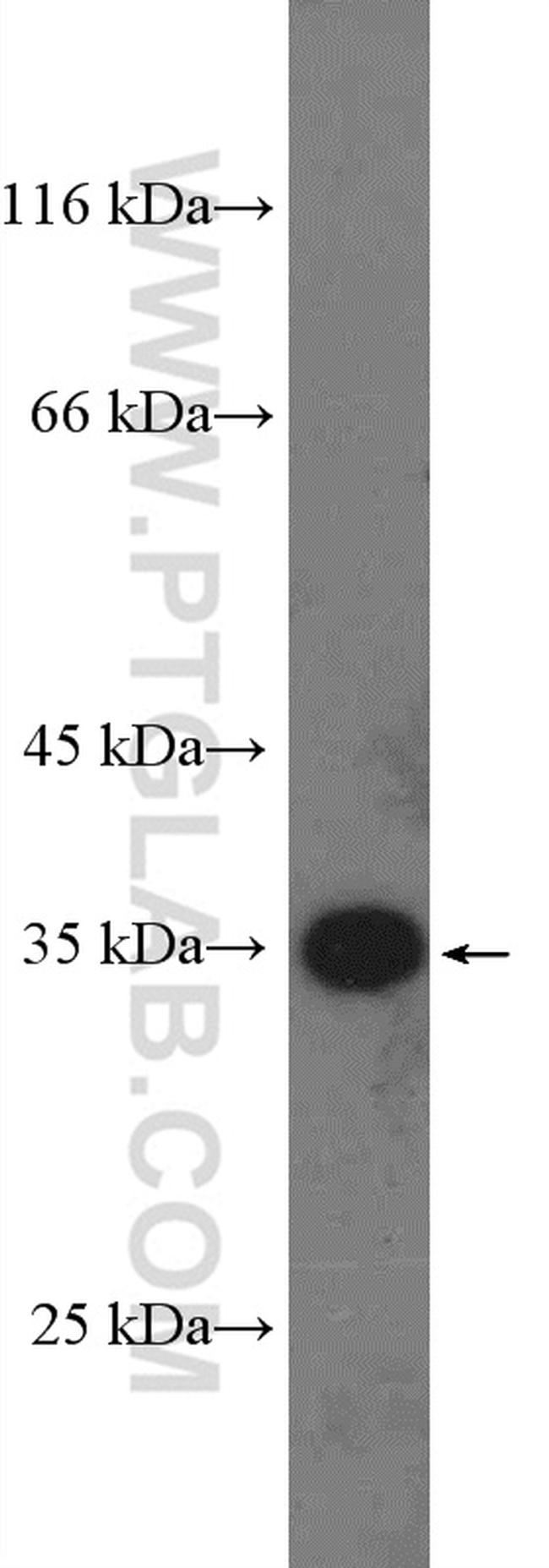 RBM7 Antibody in Western Blot (WB)