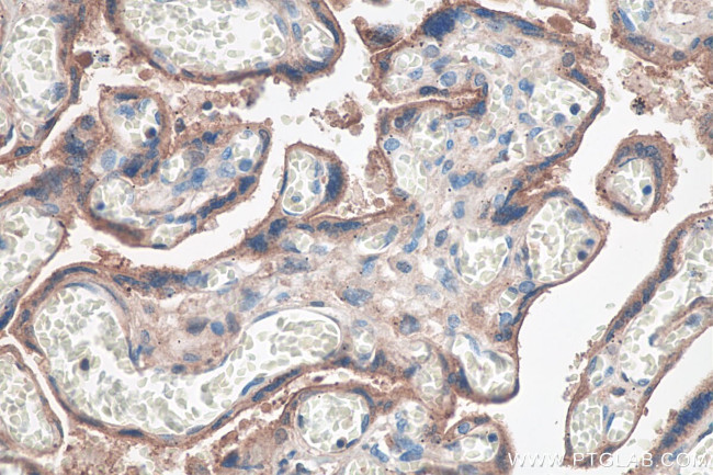 PVRL4 Antibody in Immunohistochemistry (Paraffin) (IHC (P))