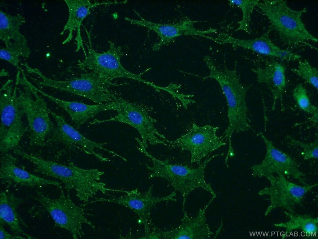 PVRL4 Antibody in Immunocytochemistry (ICC/IF)