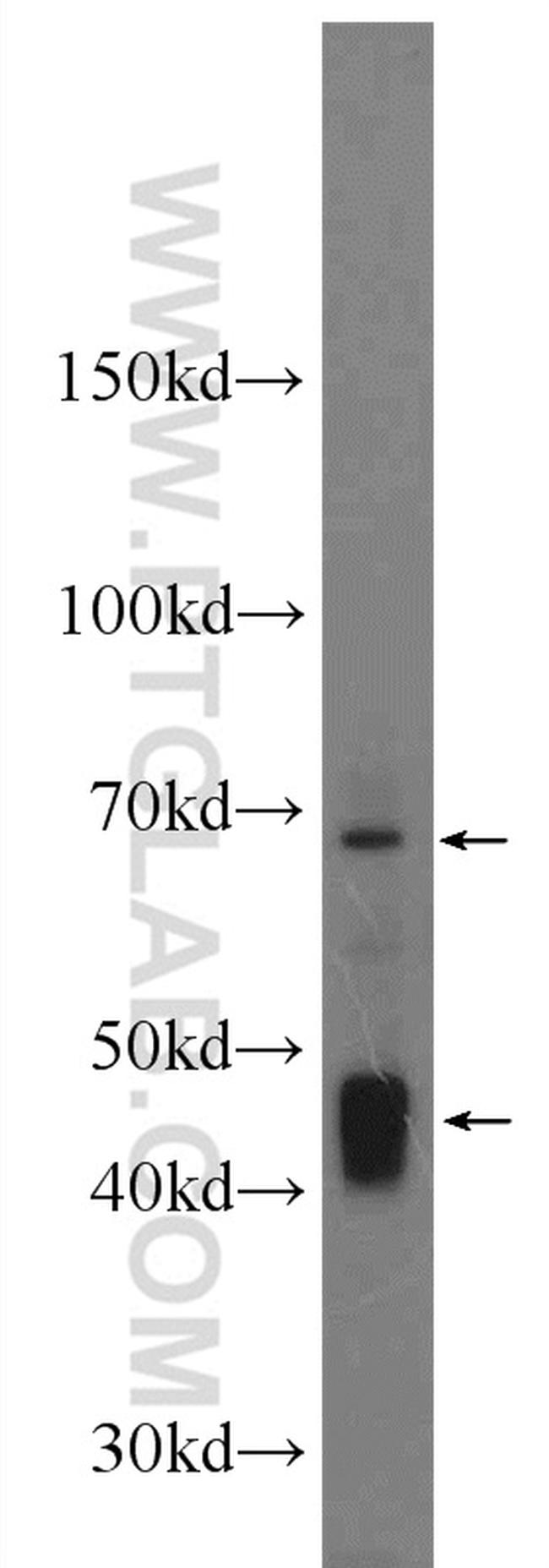 PVRL4 Antibody in Western Blot (WB)