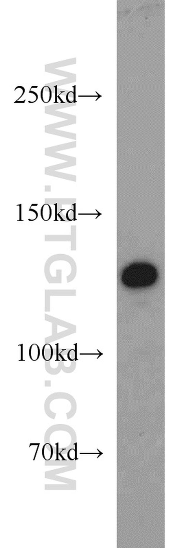 ZBTB38 Antibody in Western Blot (WB)