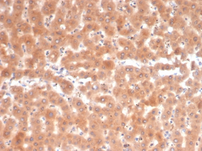 Fibroblast Activation Protein Alpha/FAP-1 Antibody in Immunohistochemistry (Paraffin) (IHC (P))