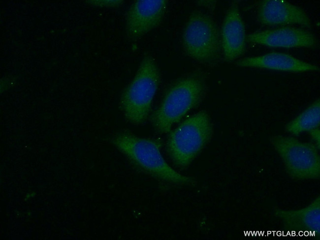 VAV2 Antibody in Immunocytochemistry (ICC/IF)