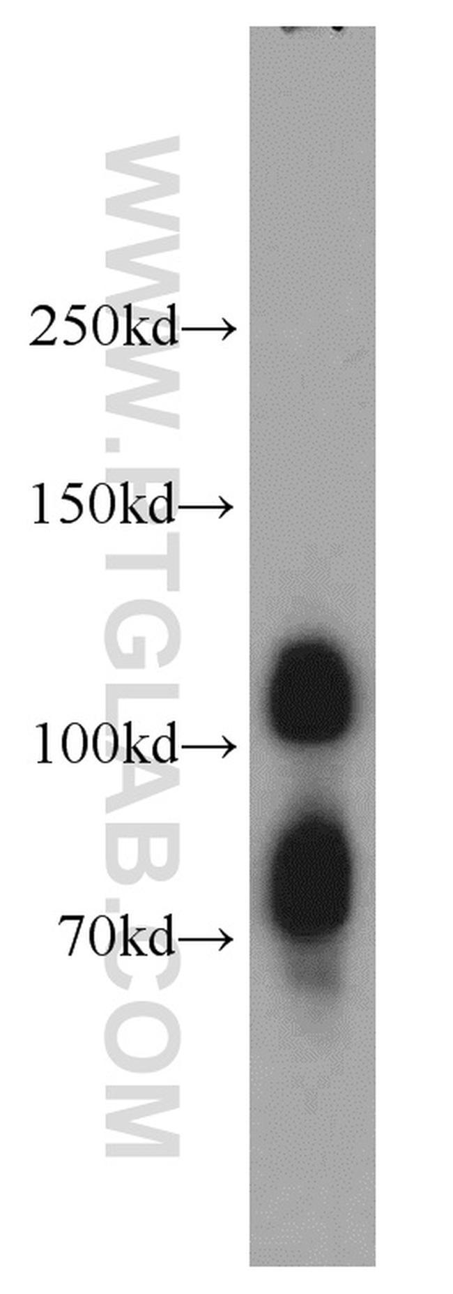 DNAJC6/AUXILIN Antibody in Western Blot (WB)