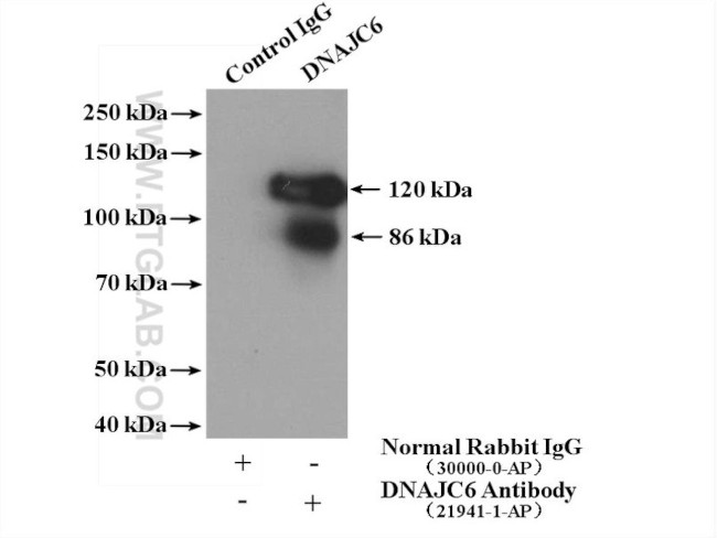 DNAJC6/AUXILIN Antibody in Immunoprecipitation (IP)