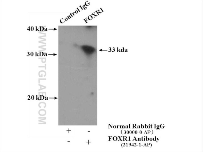 FOXR1 Antibody in Immunoprecipitation (IP)