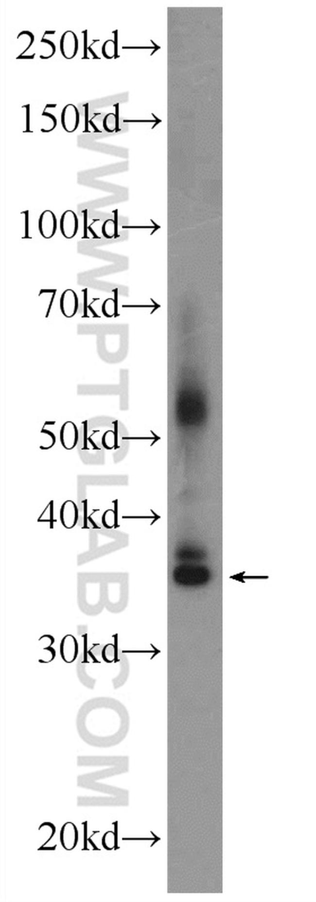 FOXR1 Antibody in Western Blot (WB)