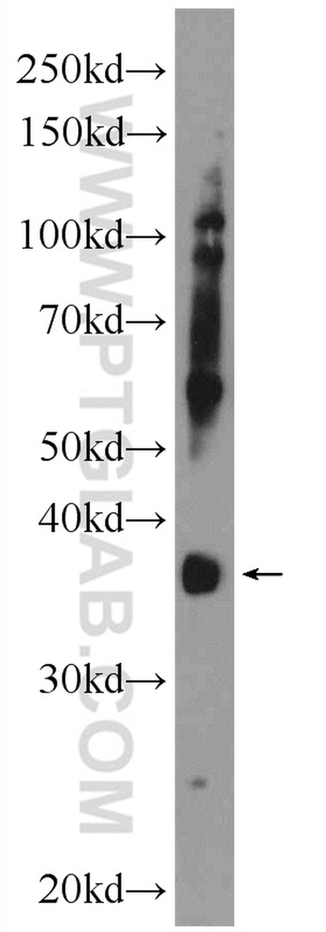 FOXR1 Antibody in Western Blot (WB)