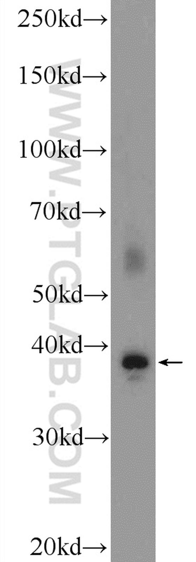 FOXR1 Antibody in Western Blot (WB)