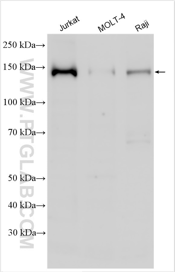NCOA1/SRC-1 Antibody in Western Blot (WB)