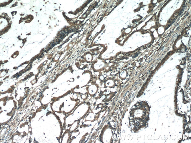 MACC1 Antibody in Immunohistochemistry (Paraffin) (IHC (P))