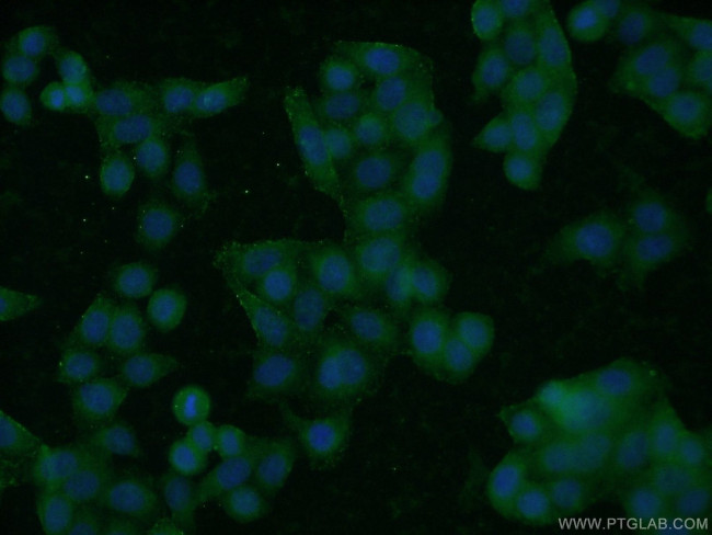 ROM1 Antibody in Immunocytochemistry (ICC/IF)