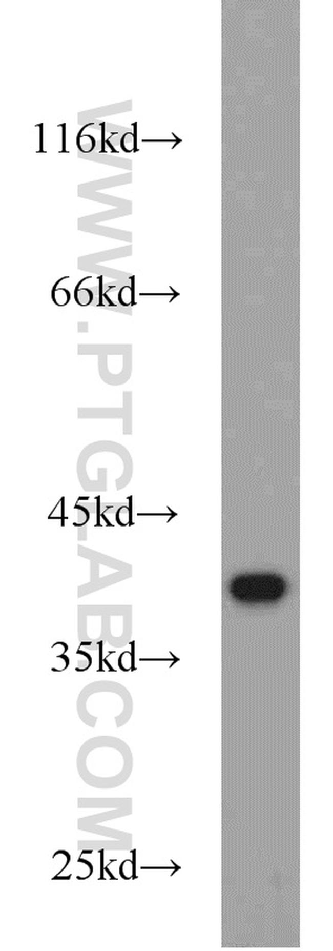 ROM1 Antibody in Western Blot (WB)