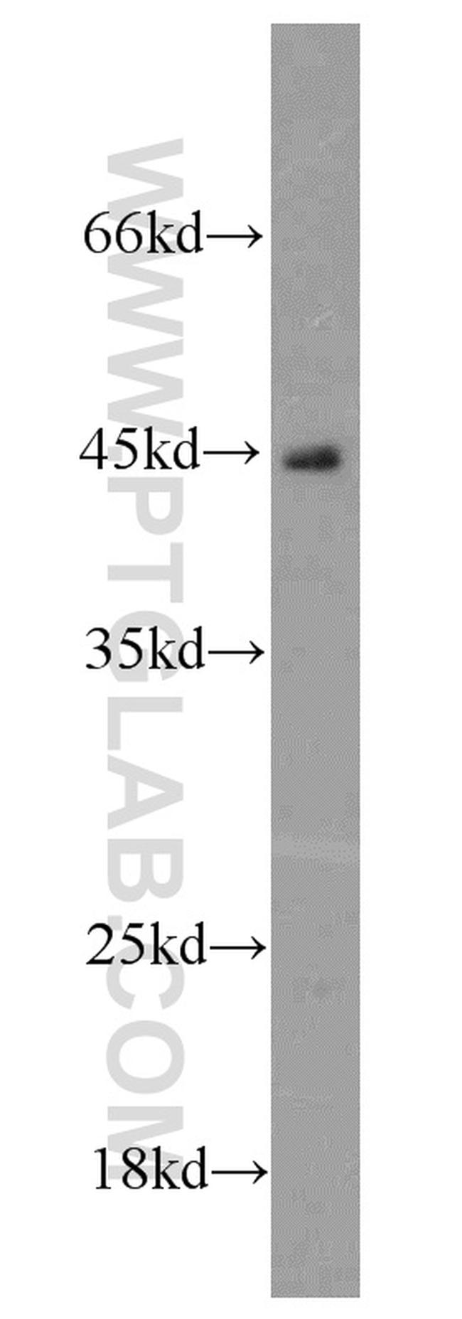 ROM1 Antibody in Western Blot (WB)